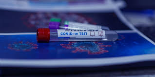 За добу в Ужгороді виявлено 9 нових випадків коронавірусної інфекції