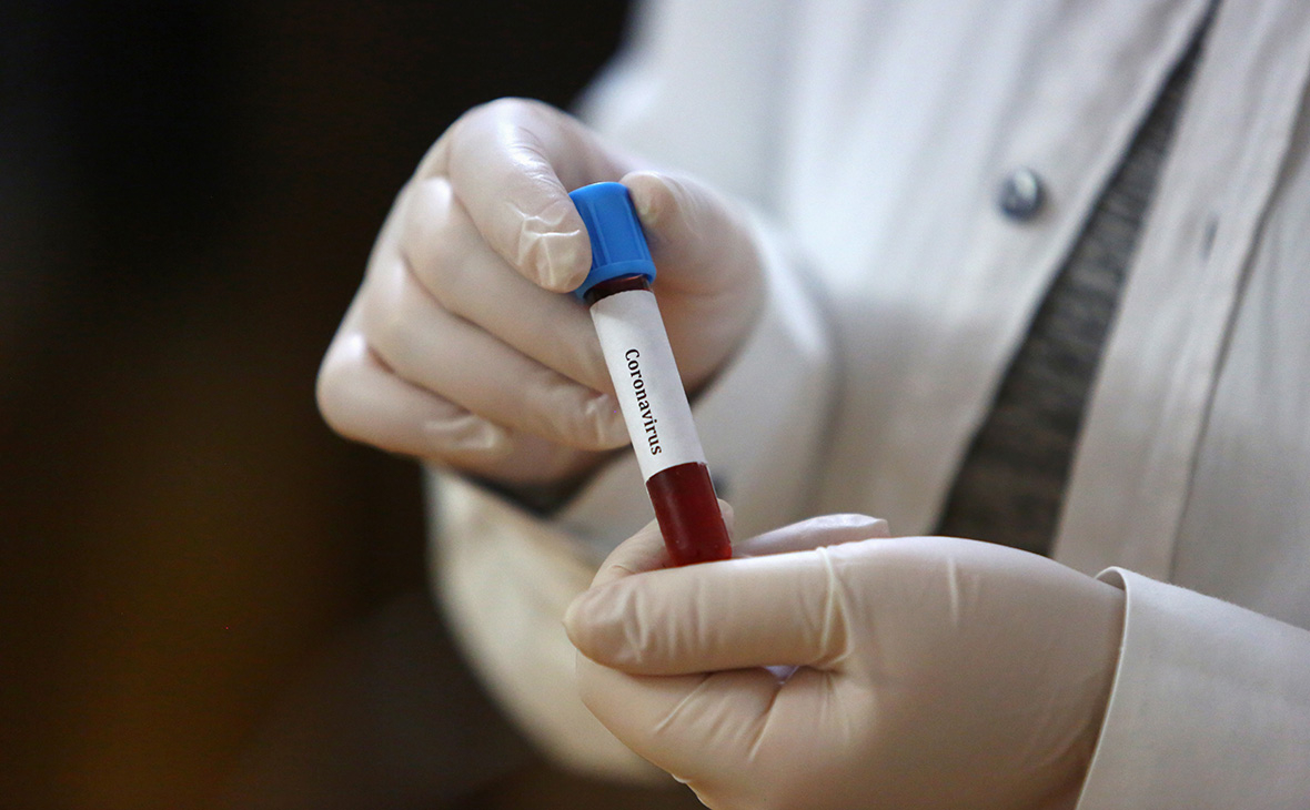 На ранок 9 січня в Ужгороді виявлено 14 нових випадків коронавірусної інфекції
