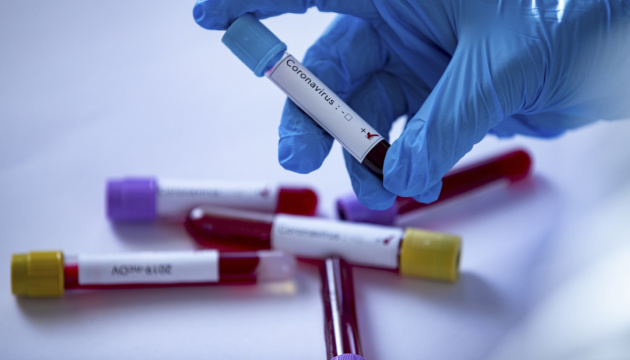 В Ужгороді за минулу добу зареєстровано 12 нових випадків коронавірусу