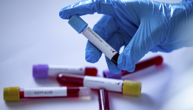 В Ужгороді за добу виявлено 35 нових випадків коронавірусу