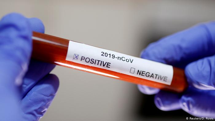 В Ужгороді виявлено 23 нові випадки коронавірусної інфекції, 2 людей померли
