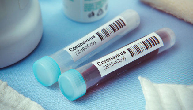 За добу в Ужгороді виявлено 99 нових випадків коронавірусної інфекції, 2 людей померли