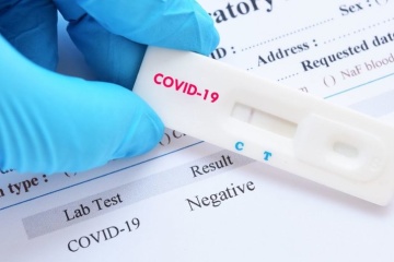 За минулу добу в Ужгороді виявлено 74 нові випадки коронавірусної інфекції, 4 хворих померли