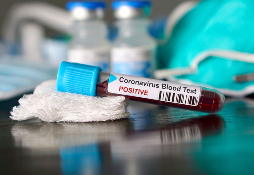 За минулу добу в Ужгороді виявлено 55 нових випадків коронавірусної інфекції, 1 людина померла