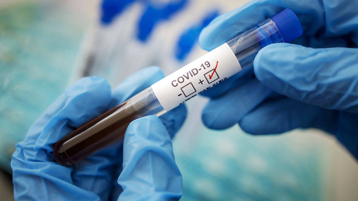 В Ужгороді за минулу добу виявлено 95 нових випадків коронавірусу, 2 людей померли