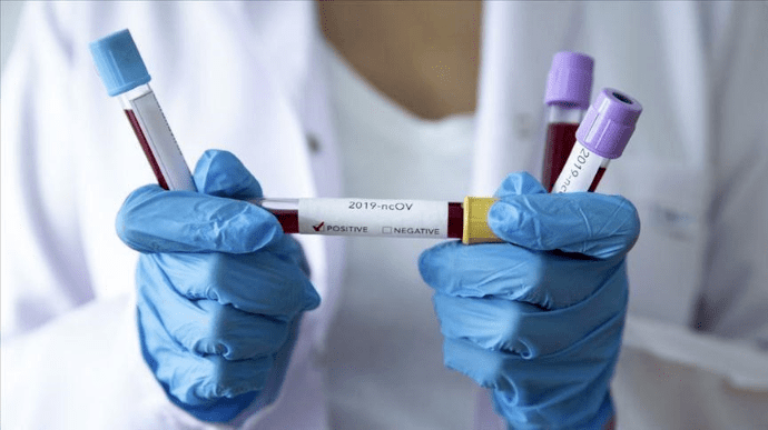 В Ужгороді впродовж доби виявлено 3  нові випадки коронавірусної інфекції, 2 людини померли