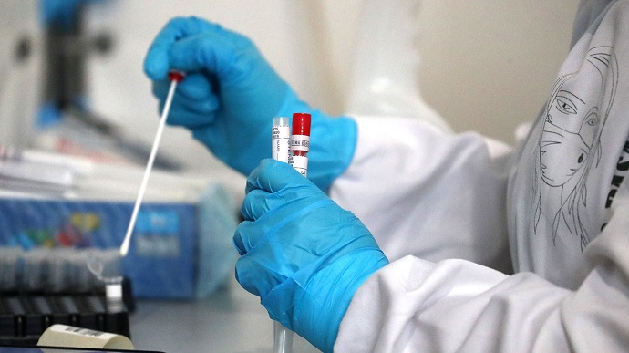 За минулу добу в Ужгороді виявлено 2 нові випадки коронавірусної інфекції  