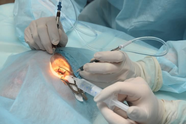 Понад 200 безкоштовних операцій мукачівцям  проводять лікарі-офтальмологи Діагностичного центру