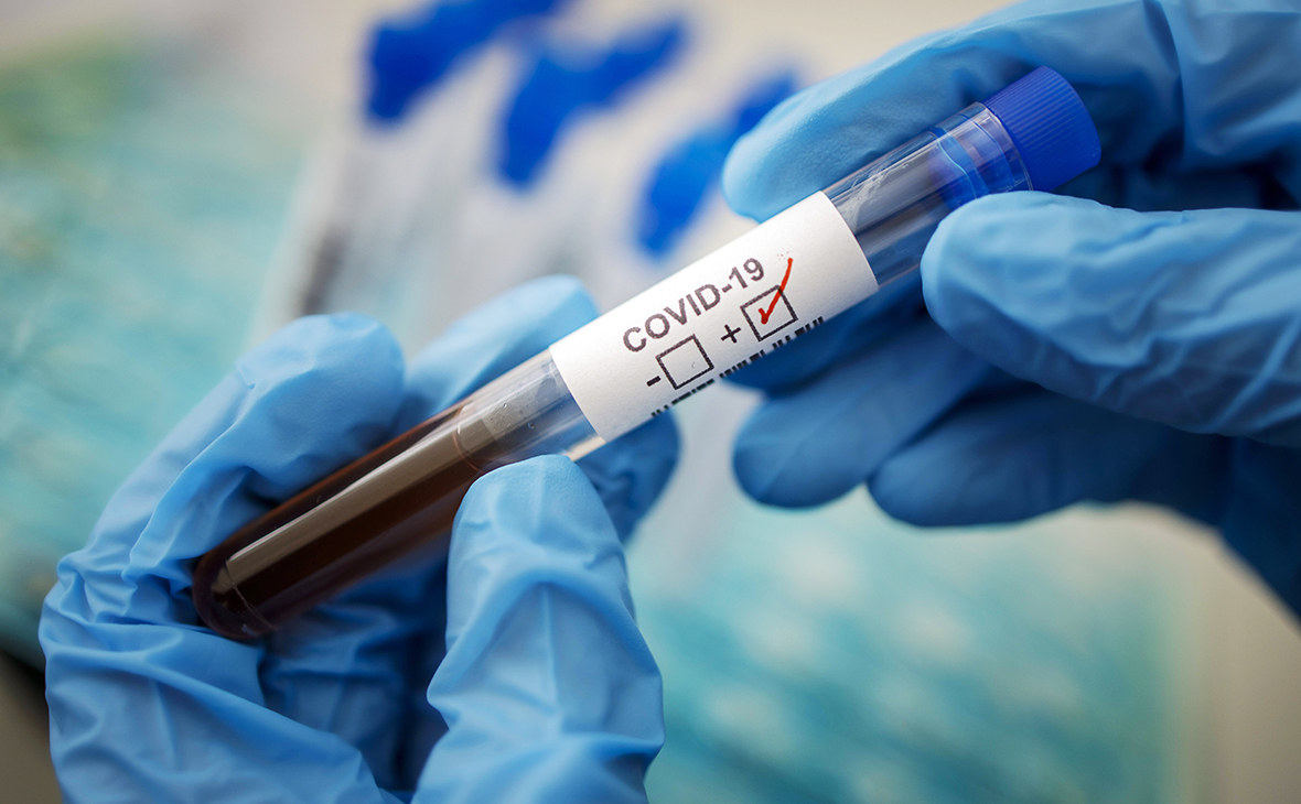 В Ужгороді за добу добу виявлено 37 нових випадків COVID-19 