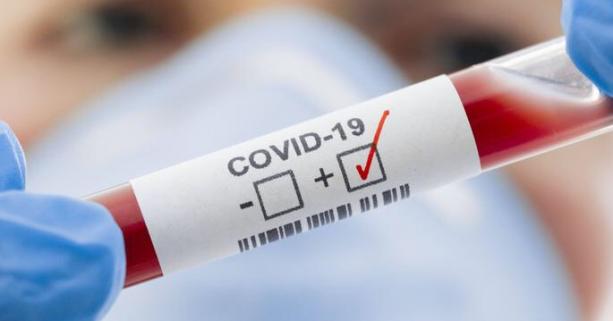 За добу на Закарпатті виявии 446 нових випадків COVID-19, 7 людей померло