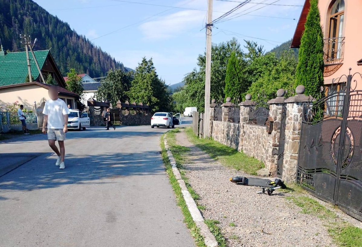 У Синевирі легковик КІА травмував 10-річного хлопчика на електросамокаті (ФОТО)