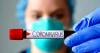 На Закарпатті зростає кількість випадків COVID-19 