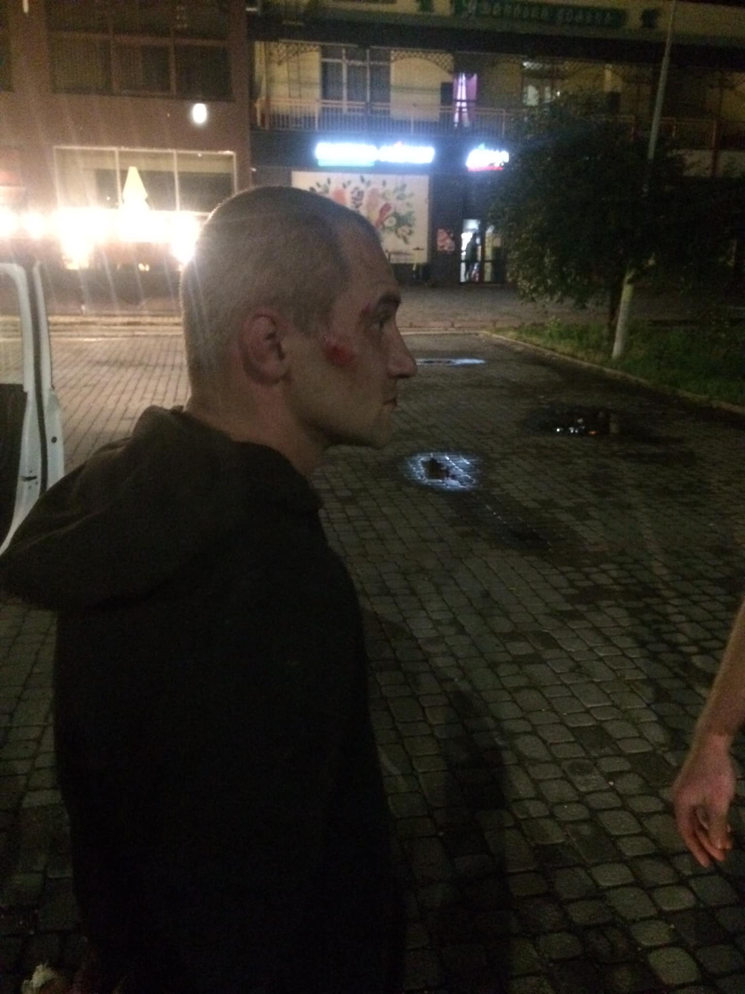 Ужгородці оприлюднили фото затриманого грабіжника, що зірвав ланцюжок з шиї жінки (ФОТО)