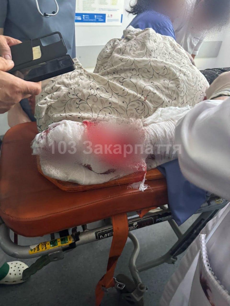 На Тячівщині медики борються за кінцівки 17-річного хлопця після нещасного випадку